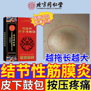 结节性筋膜炎手臂小腿特皮下鼓包效肿块肌肉拉伤硬结疼痛膏药贴CA