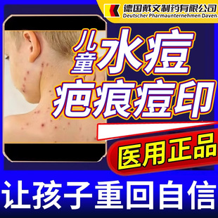 水痘坑疤痕去痘印痘坑痘疤药房同售膏去黑色素沉淀去疤医用型CA