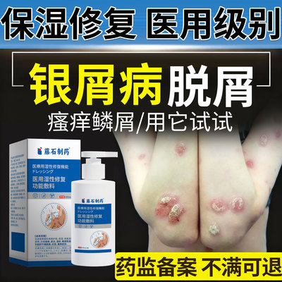 药房同售银屑病身体乳泡澡包皮肤止痒外用膏沐浴露牛皮癣浴顽固SK