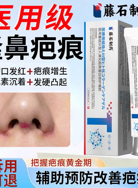 隆鼻术后鼻翼鼻小柱疤痕修复凝胶防增生淡化黑色素医用祛疤VX