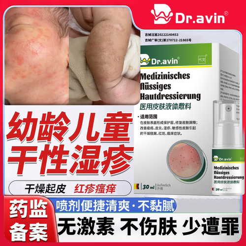 儿童干性湿疹婴儿医用级修复喷剂