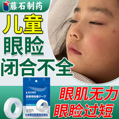 儿童眼睑闭合不全医用胶带成人睡觉眼睛闭不上眼贴神器低敏矫正SK