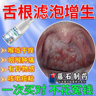 舌根长疙瘩咽喉炎慢性咽炎除有异物感根舌根咽后壁淋巴滤泡增生CA