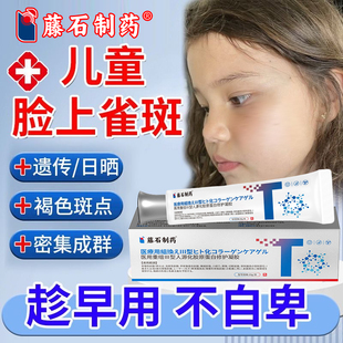 儿童脸上有长雀斑祛专用霜膏小孩子老年斑强力黄褐斑点晒斑去CA