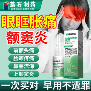 额窦炎头疼头痛鼻窦炎洗鼻器眼眶疼眉框胀痛上颌窦炎热敷贴喷剂CA