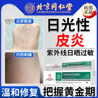 药房同款日光性皮炎紫外线过敏太阳晒伤专用皮肤发痒修复霜膏CA