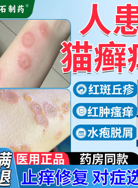 猫癣人用药房同售人患得猫癣专用皮肤红斑瘙痒疼痛真菌感染CA