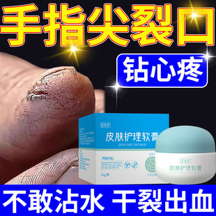 手指尖开裂裂口干裂脱皮粗糙修复霜手裂口子手裂的药房同售膏CA