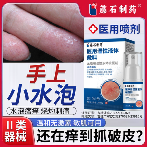 藤石制药手上汗疱疹止痒皮炎湿疹瘙痒儿童起小水泡喷剂汗状疱疹PG