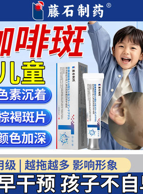 儿童咖啡斑脸部胎记神经纤维瘤膏贴皮肤牛奶咖啡斑去除神器SK