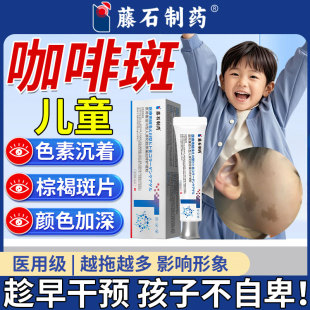 儿童咖啡斑脸部胎记神经纤维瘤膏贴皮肤牛奶咖啡斑去除神器SK