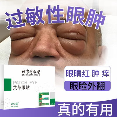 眼皮红肿过敏痒干涩医用冷敷贴