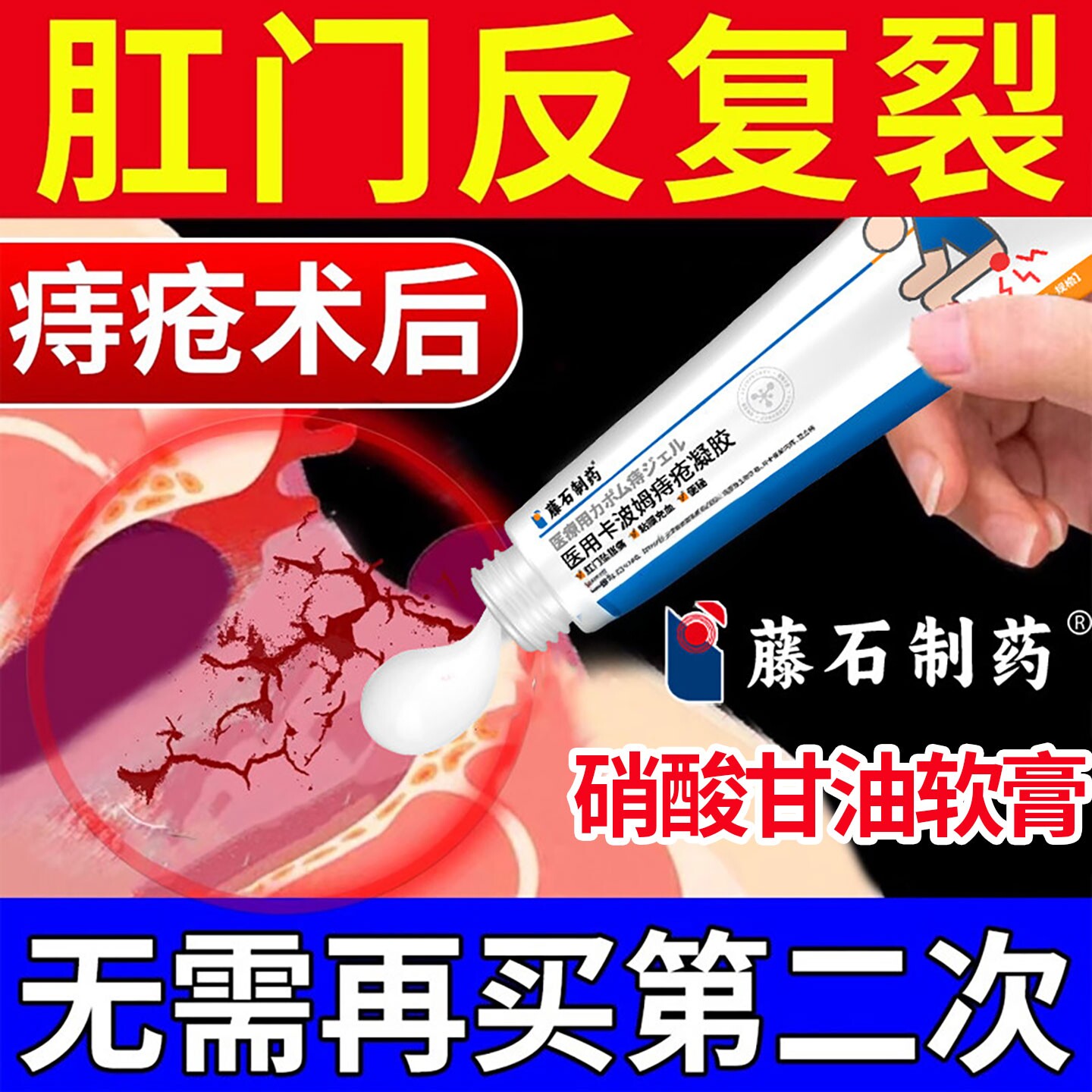 痔疮肛裂肛舒宁凝胶可搭便血止痛肛周皲裂愈合膏坐浴药房同售用SK