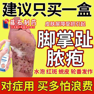 掌趾脓疱病掌跖脓包角化病症手脚角化脱皮干裂搭糖皮质激素软膏CA