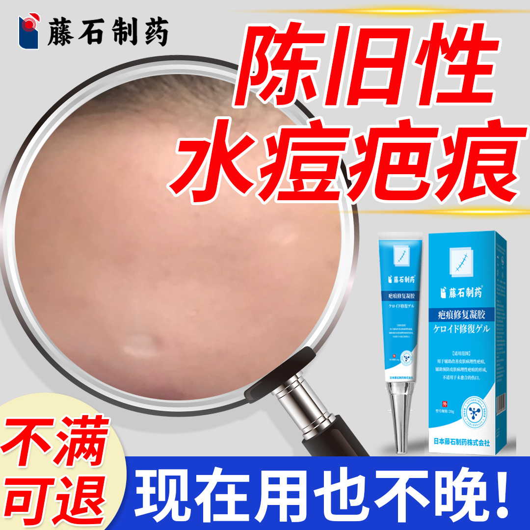 陈旧性水痘疤痕修复去水痘坑祛疤膏去除贴痘印成人凹陷生长因子CA