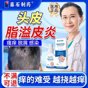 头皮脂溢性皮炎头痒头屑真菌感染毛囊炎屏障受损头癣止痒喷雾剂SK