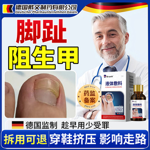 脚趾阻生甲产后脚趾甲断裂疼痛变厚分层修复矫正营养液药房同售VX