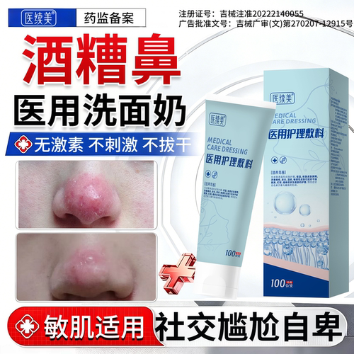 酒糟鼻玫瑰痤疮医用洗面奶红鼻子草莓鼻专用修复药房同售鼻头红QK