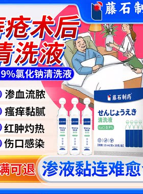 痔疮术后护理肛周脓肿肛瘘术后冲洗液坐浴护理用品肛部恢复清洗SK
