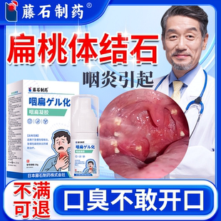 扁导体结石喷剂贴喉咙肿痛肥大异物吞咽可搭去除工具吸取器N6