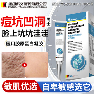 祛痘印痘坑凹洞修复生长因子男士医用型祛疤膏护理填充再生淡化QK
