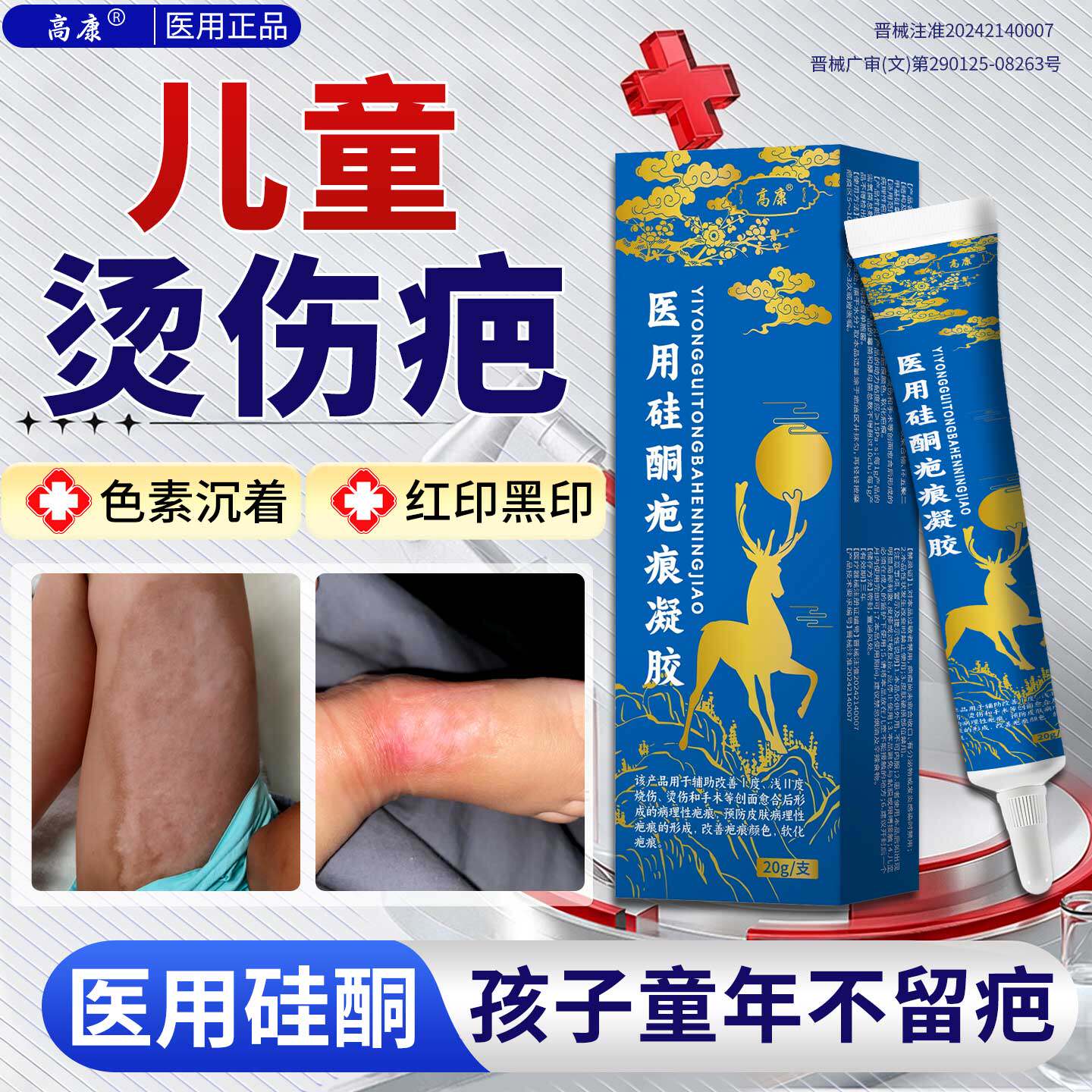 儿童烫伤去黑印色素沉淀疤痕修复除疤膏热油烧伤淡化疤印凝胶SA