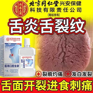 舌炎舌裂纹调理地图舌头有裂痕齿痕舌专特用效药房同售可搭喷剂QK