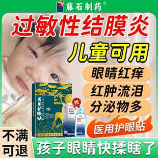 儿童过敏性结膜炎可搭眼药水医用冰敷贴眼贴眼睛痒干眼症PG