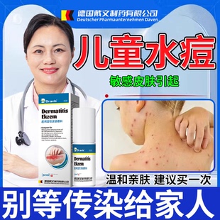 儿童水痘止痒搭藤石制药带状疱疹膏喷剂水痘外用膏疤痕去水痘坑CA