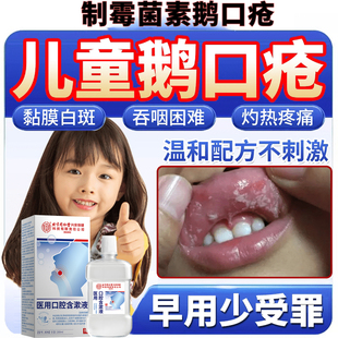 鹅口疮专用喷剂搭碳酸氢钠制霉菌含漱液口腔溃疡白斑黏膜素片SK
