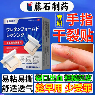医用手指干裂贴防水手脚皲裂裂口愈合膏贴胶布护手指开裂炸血口CA