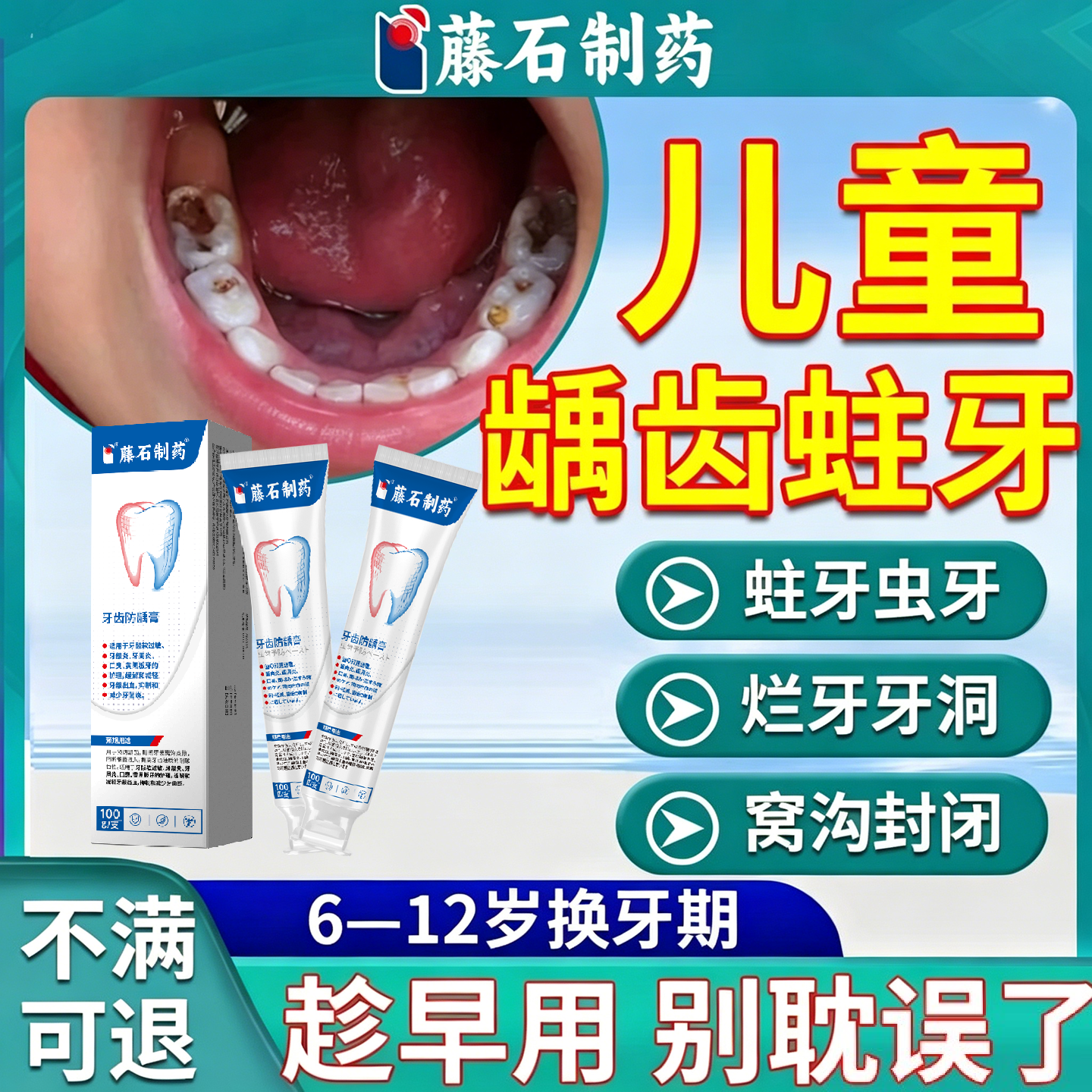补牙缝蛀牙专用搭牙膏牙齿防龋凝胶修复牙齿黑线6-12岁换牙期SK