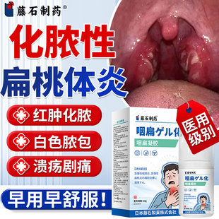 化脓性扁桃体炎喉咙发炎白色脓包点专用喷雾溃疡急慢性咽炎喷剂SK