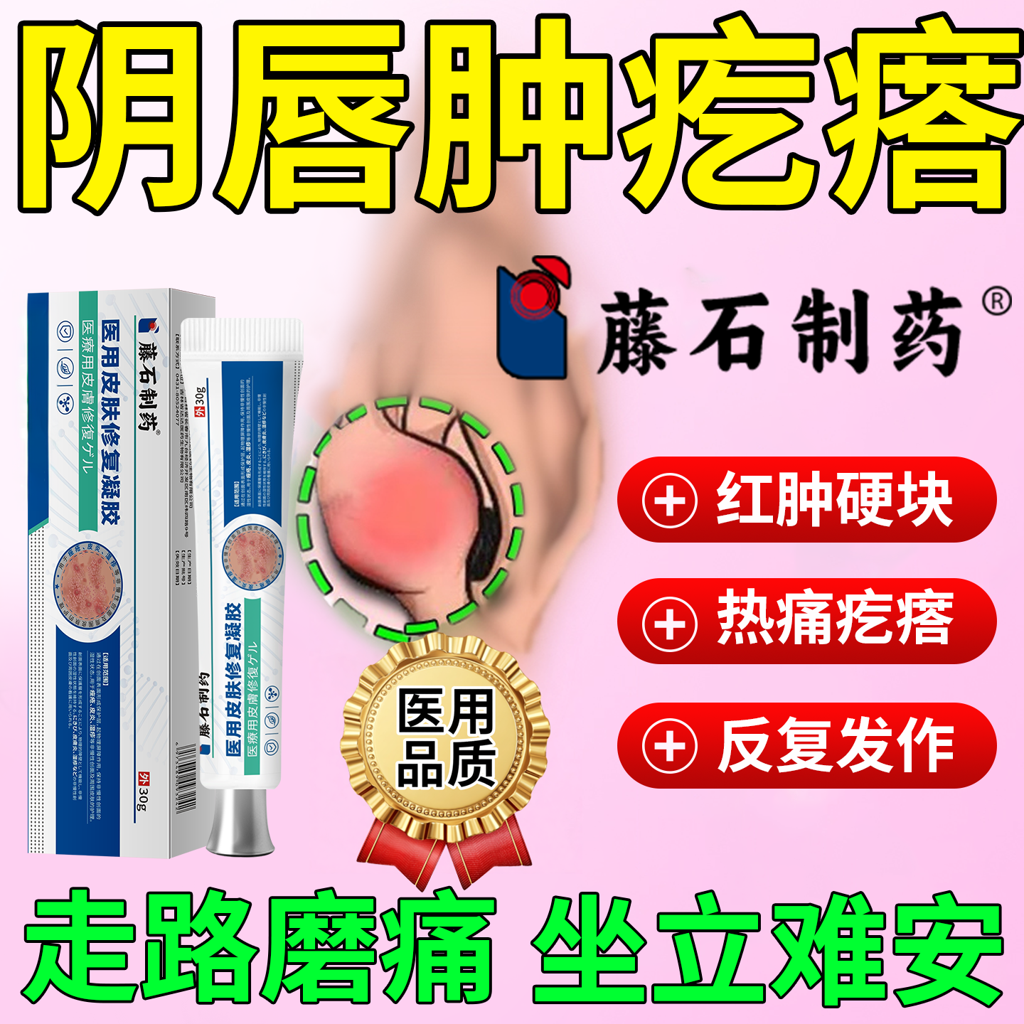 前庭大腺巴氏腺囊肿疏通外阴毛囊炎阴唇长硬疙瘩膏肿痛药监备案PG