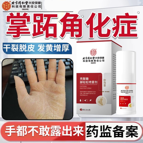 掌跖角化症掌趾手掌心脓包疱发黄增厚硬皮角化型湿疹膏脱皮干裂PG