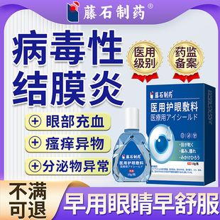 病毒性结膜炎角膜炎滴眼液结膜充血眼睛疼痛畏光流泪可搭眼药水SK