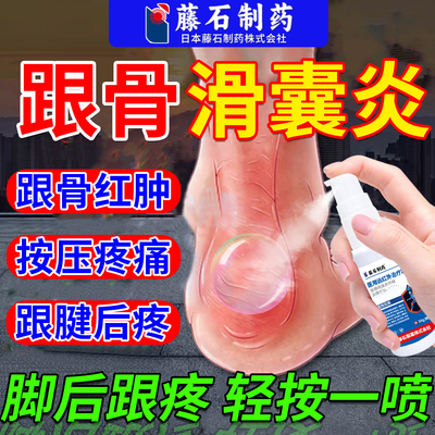 足跟痛足跟骨滑囊炎脚后跟疼喷雾剂止痛骨膜跟腱炎贴膏药房同售JA