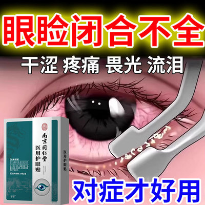 眼睛眼睑闭合不全暴露性角膜炎干涩有异物感畏光流泪睡觉闭眼贴CA