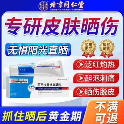 紫外线过敏专用药膏太阳晒伤皮肤发痒皮肤晒伤修复药房同售膏js