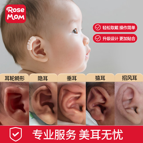 新生儿宝宝耳朵定型矫正器矫正贴