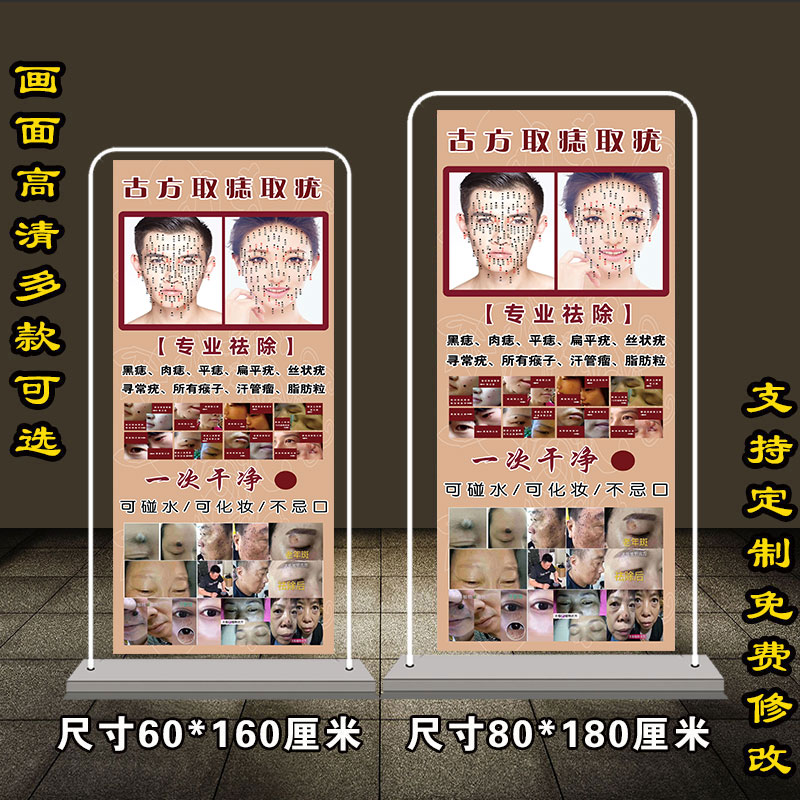 男女面痣图古方取痣取疣宣传海报