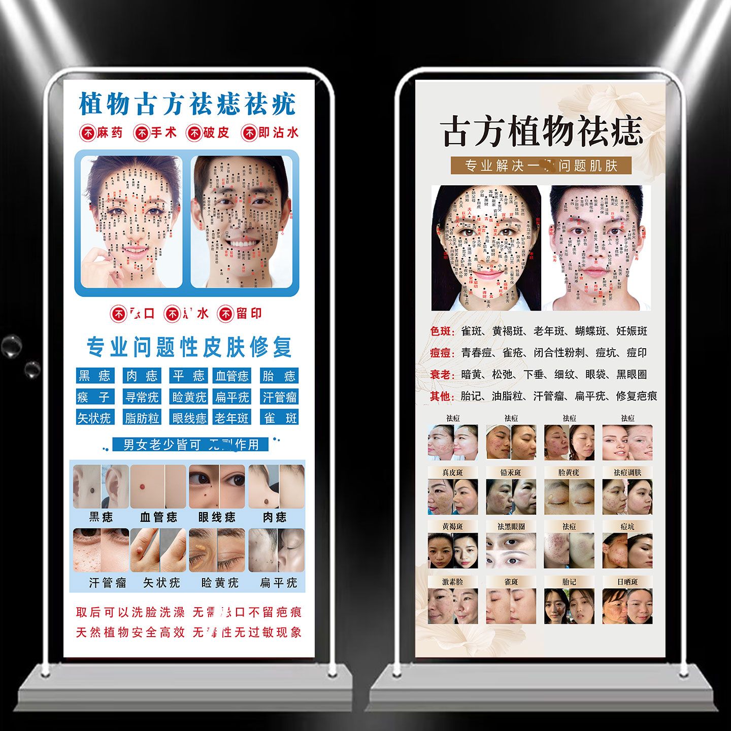 点痣图展架男女面痣图写真广告