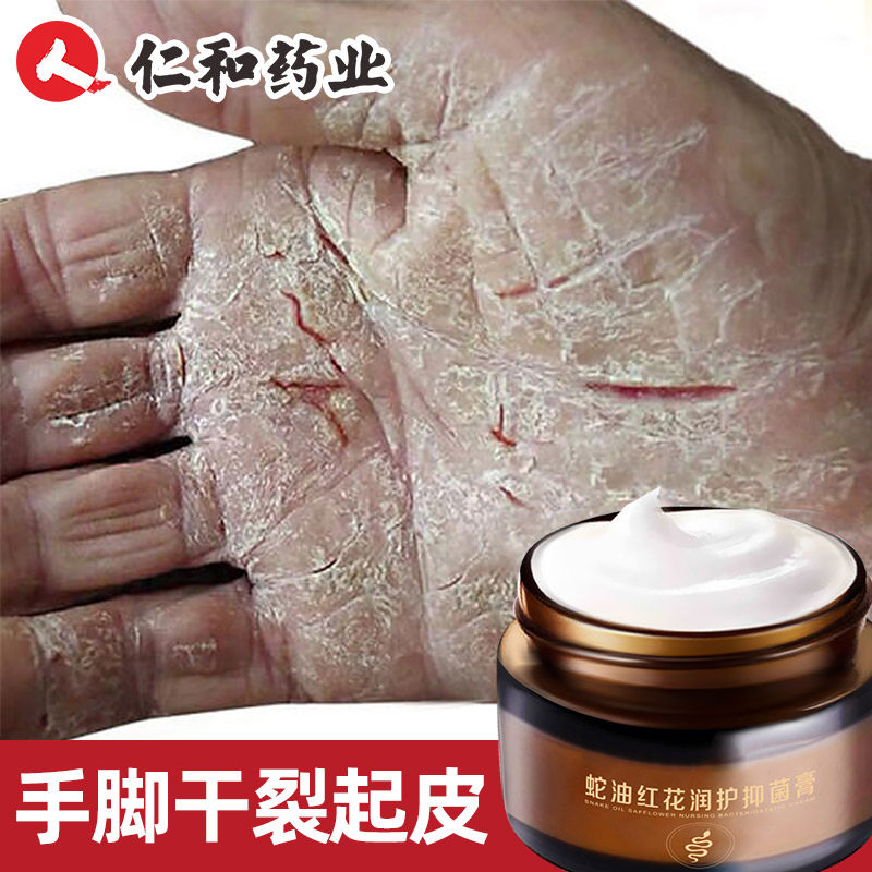 仁和皲裂膏手干手裂非油裂口子膏手上裂口子手裂灵护手霜防裂老式