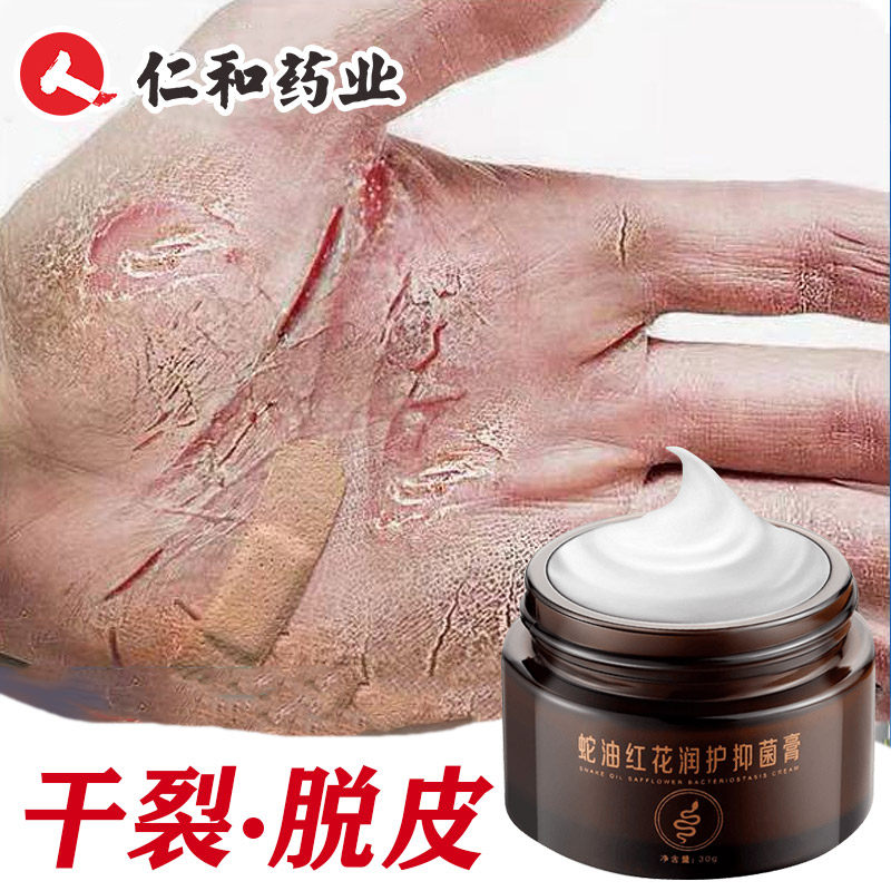 仁和蛇油膏手脚裂口手指手足干裂开裂皲裂愈裂修复防裂护手霜开口