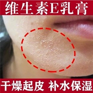 脸干燥起皮上火脸起皮肤蜕皮红肿干痒发痒保湿补水脸部修护面霜男