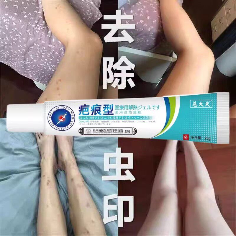 蚊虫叮咬祛疤膏去除蚊子黑疤印去黑色素沉淀咬的虫咬印淡化跳蚤咬
