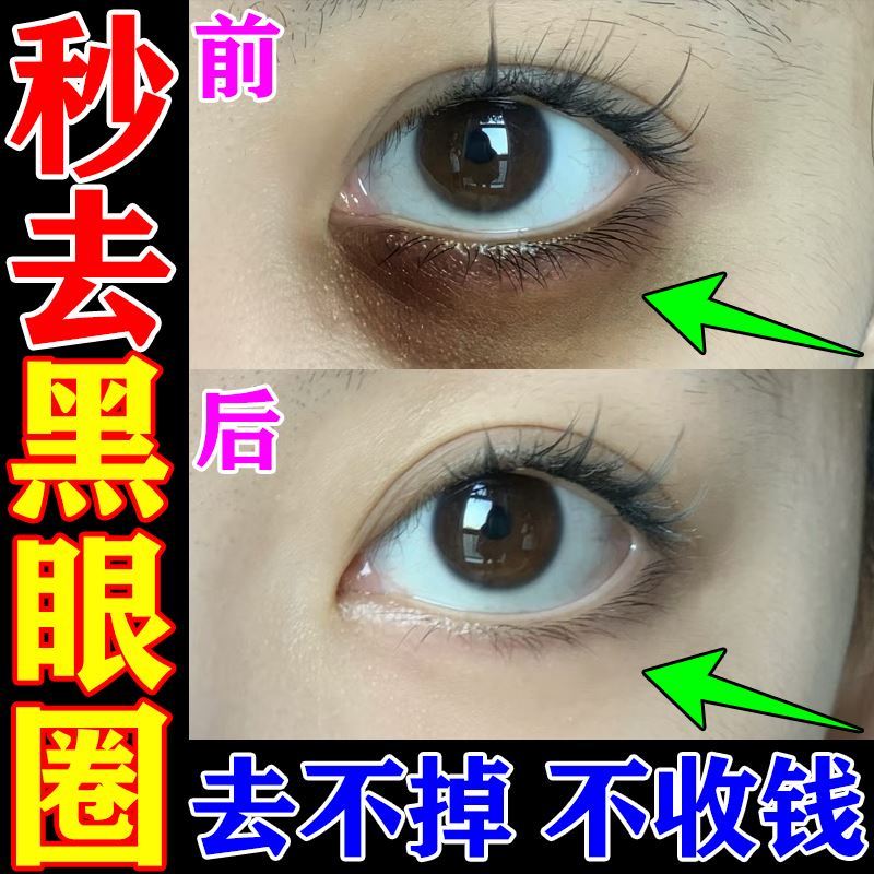 黑眼圈去除神器特别严重眼霜淡化细纹提拉紧致抗衰消男士眼袋熬夜