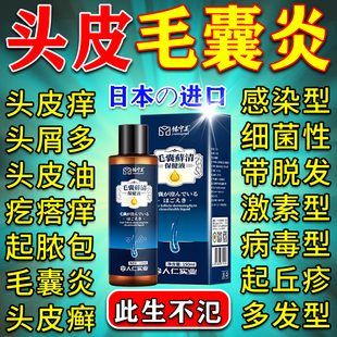 治疗头部头皮毛囊炎特膏效的药溢脂性头部专用痒有疙瘩头上长痘痘