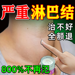 淋巴结肿大散结膏贴特效消炎药消除神器脖子颈部腋下副乳耳后水肿