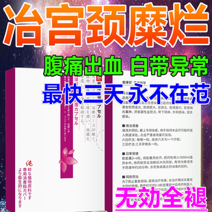 氧氟沙星胶囊逸舒甘盐酸左粒